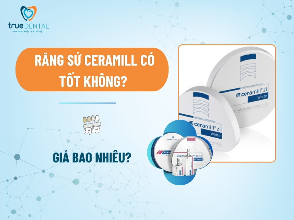 Răng sứ Ceramill có tốt không? Giá bao nhiêu? 7 Răng sứ Ceramill có tốt không? Giá bao nhiêu?