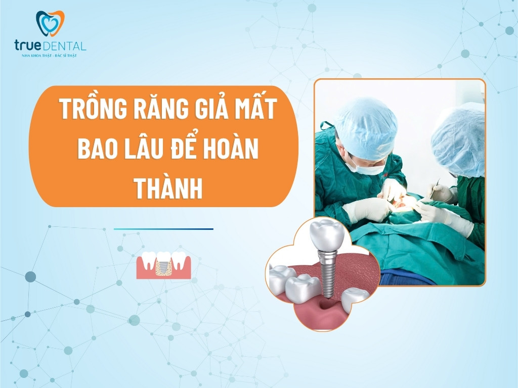 Trồng răng giả mất bao lâu để hoàn thành?