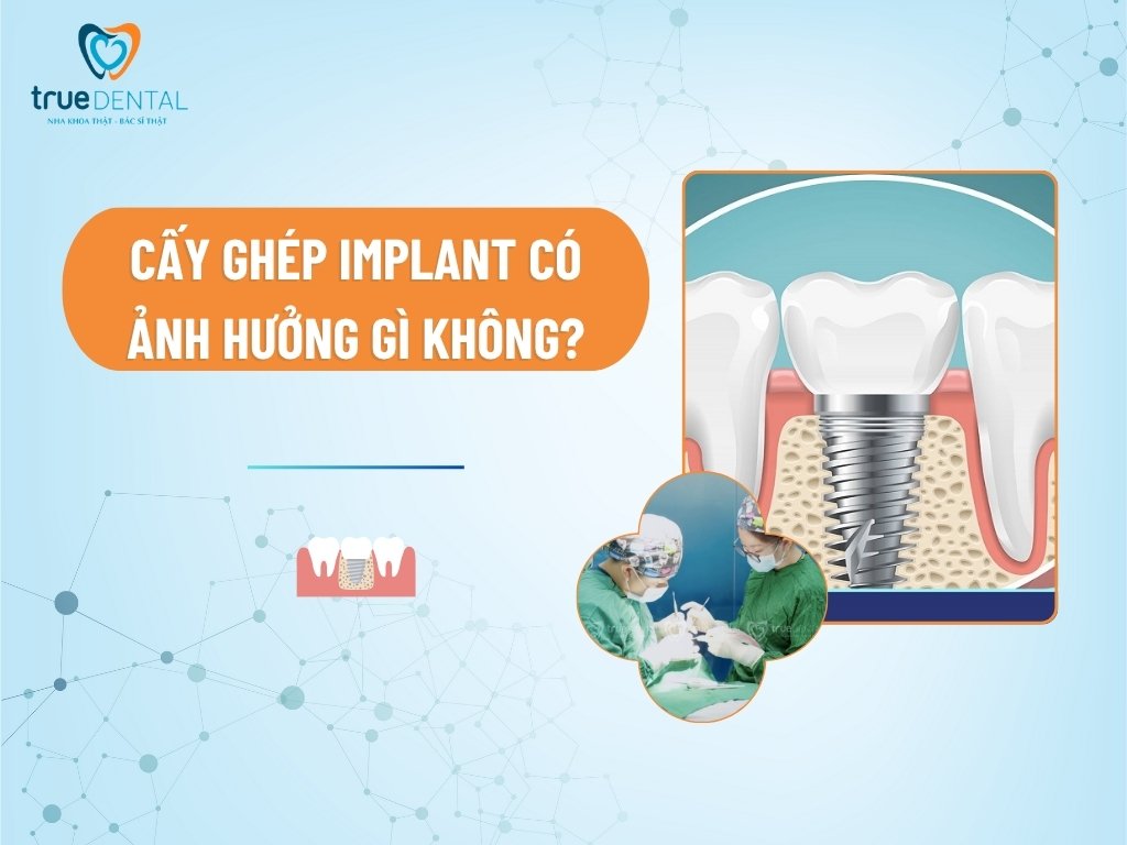Cấy ghép Implant có ảnh hưởng gì không?