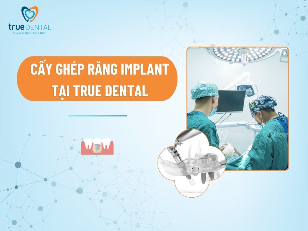 Cấy ghép răng Implant tại True Dental