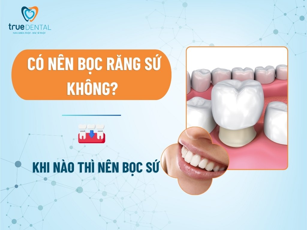 Có nên bọc răng sứ không? Khi nào thì nên bọc sứ 5 Có nên bọc răng sứ không? Khi nào thì nên bọc sứ