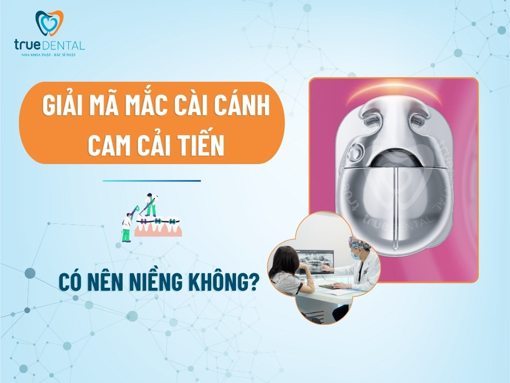 Giải Mã Mắc Cài Cánh Cam Cải Tiến: Có Nên Niềng Không?