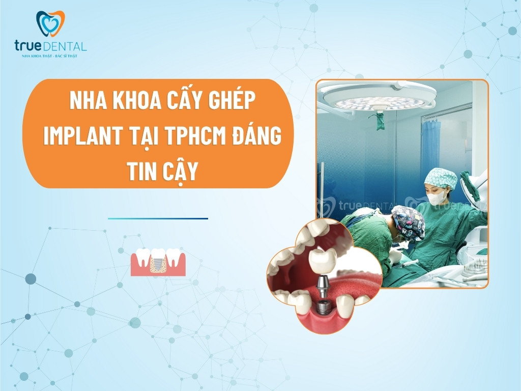 Nha khoa cấy ghép Implant tại TPHCM đáng tin cậy