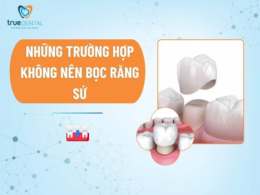Những trường hợp không nên bọc răng sứ 3 Những trường hợp không nên bọc răng sứ