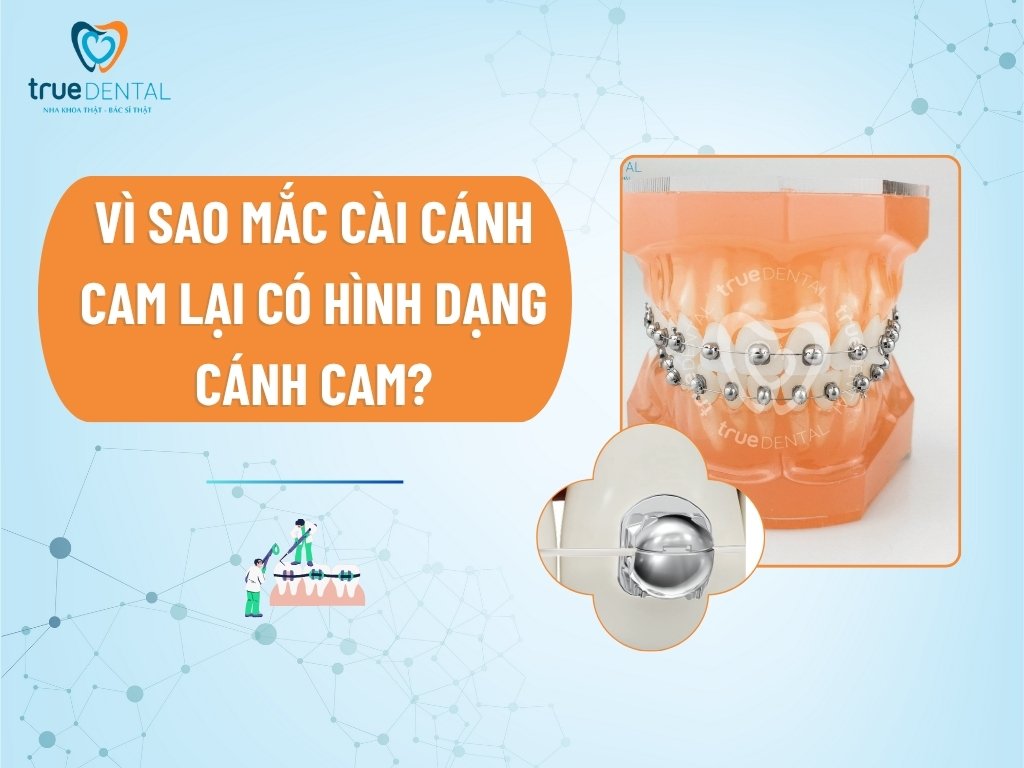 Vì sao mắc cài cánh cam lại có hình dạng cánh cam?