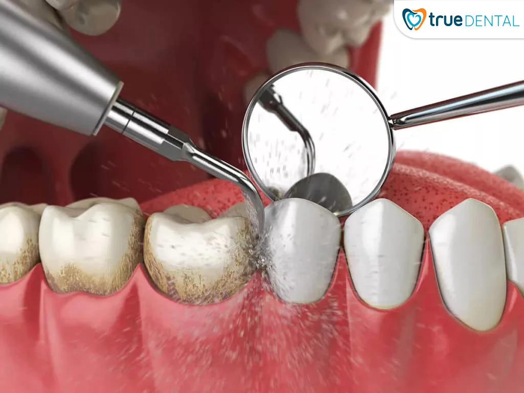 Cách kiểm tra men răng tại nhà