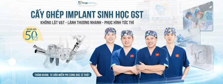 Chi phí cấy ghép implant cho người mất nhiều răng