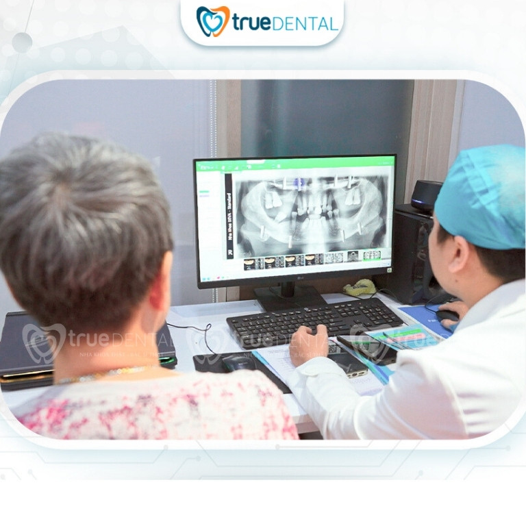 Cách giảm đau sau cấy ghép implant