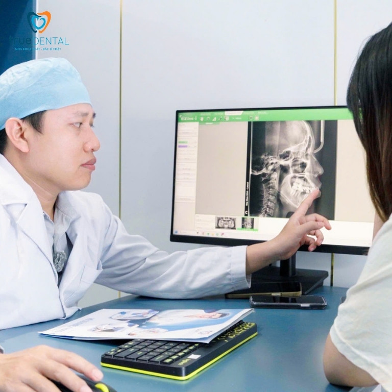 Niềng răng cho răng vẩu nhẹ