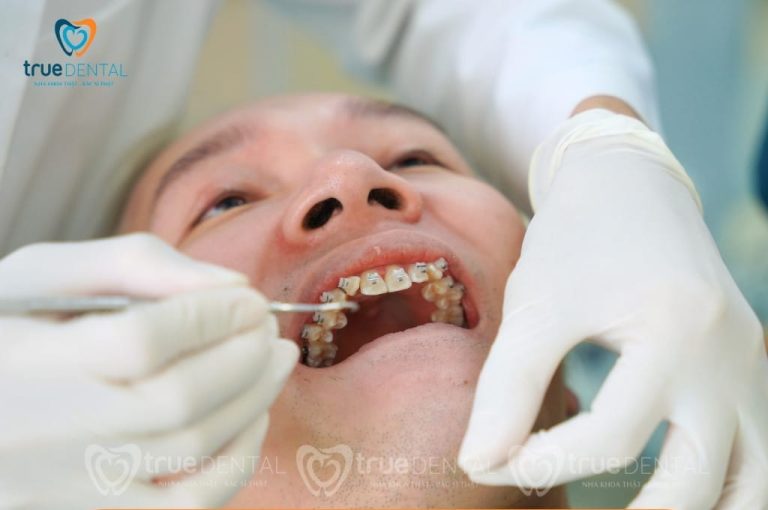 Niềng răng ở người bị cao huyết áp