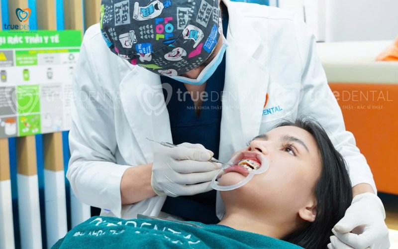 so sánh niềng răng và chỉnh nha