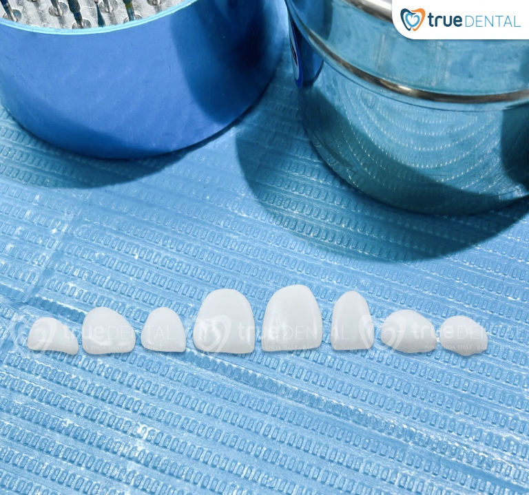 Lợi ích bọc răng sứ lâu dài – Tất cả những gì bạn cần biết trước khi quyết định 21 Lợi ích bọc răng sứ lâu dài