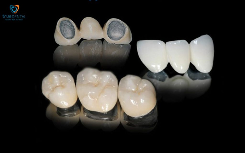 Rủi ro dị ứng với răng sứ – Nguyên nhân, dấu hiệu và cách xử lý an toàn tại Nha khoa True Dental 43 Rủi ro dị ứng với răng sứ